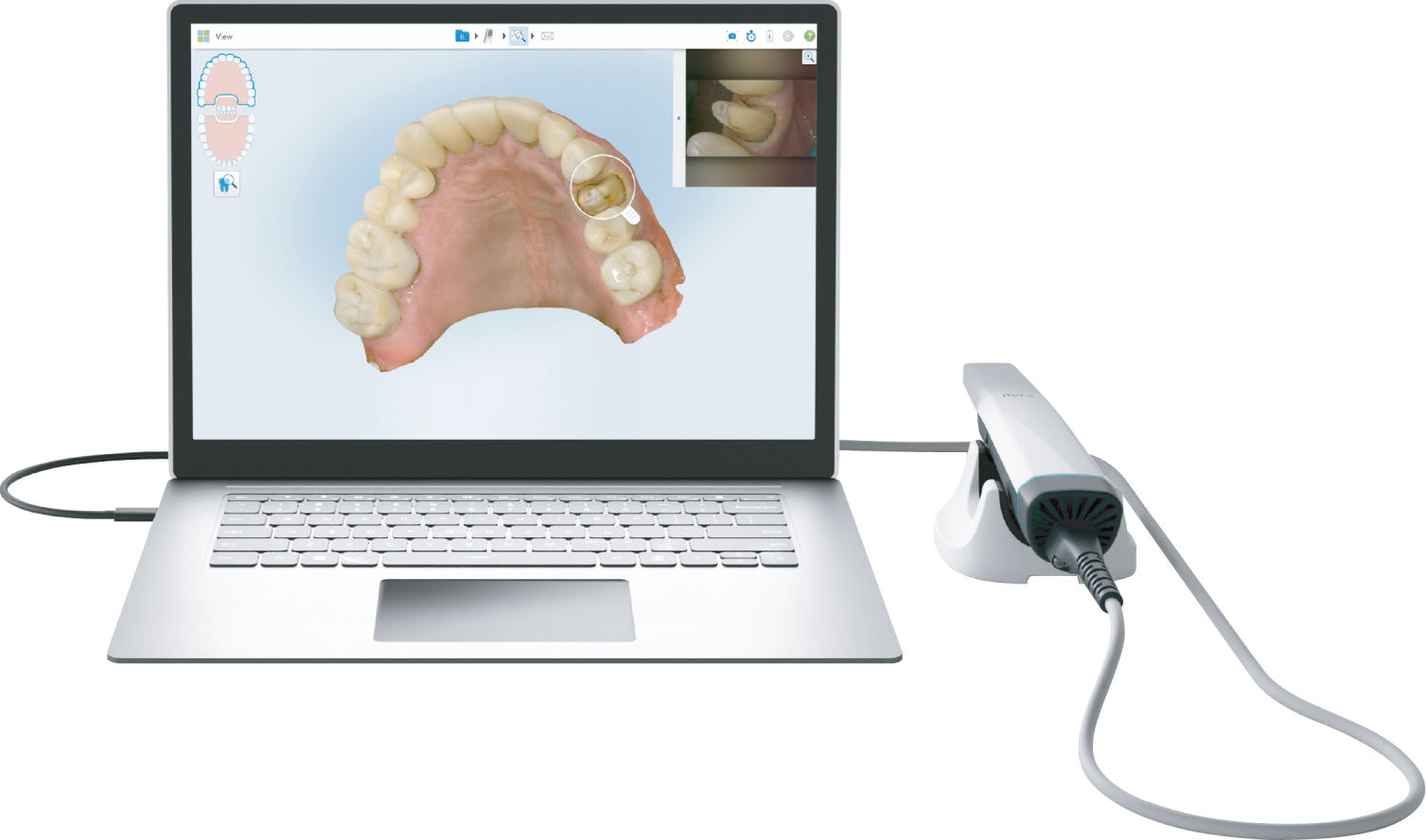 iTero Lumina PC スターター 補綴・矯正｜オンラインカタログ internet